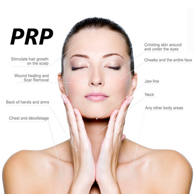 Halo Medispa PRP skin rejuvenation vampire facial for women